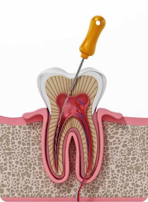 Endodonzia