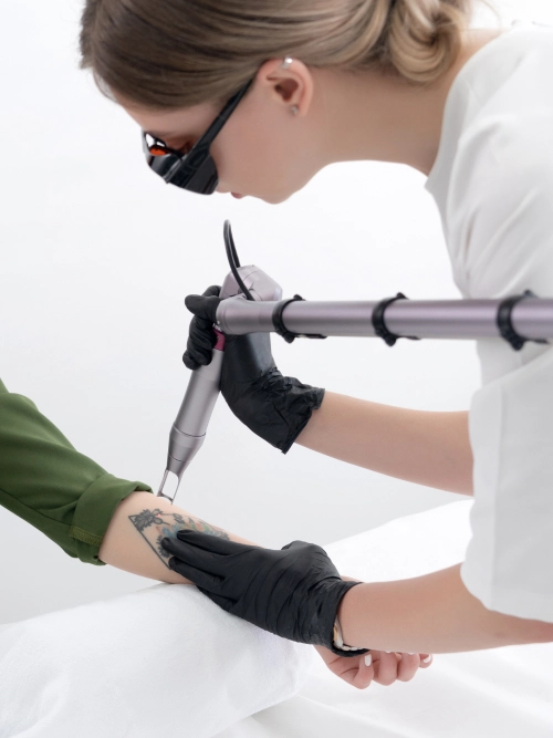 Laser Rimozione Tatuaggi Seregno - You Medical